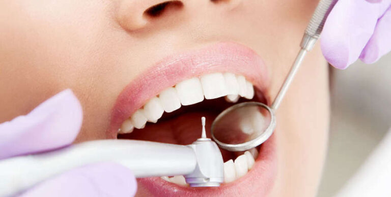 Яка ціна на лікування зубів у Львові?