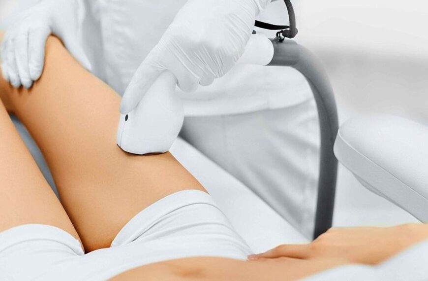 Лазерна чи ЕЛОС епіляція: що краще та як обрати ідеальний метод?